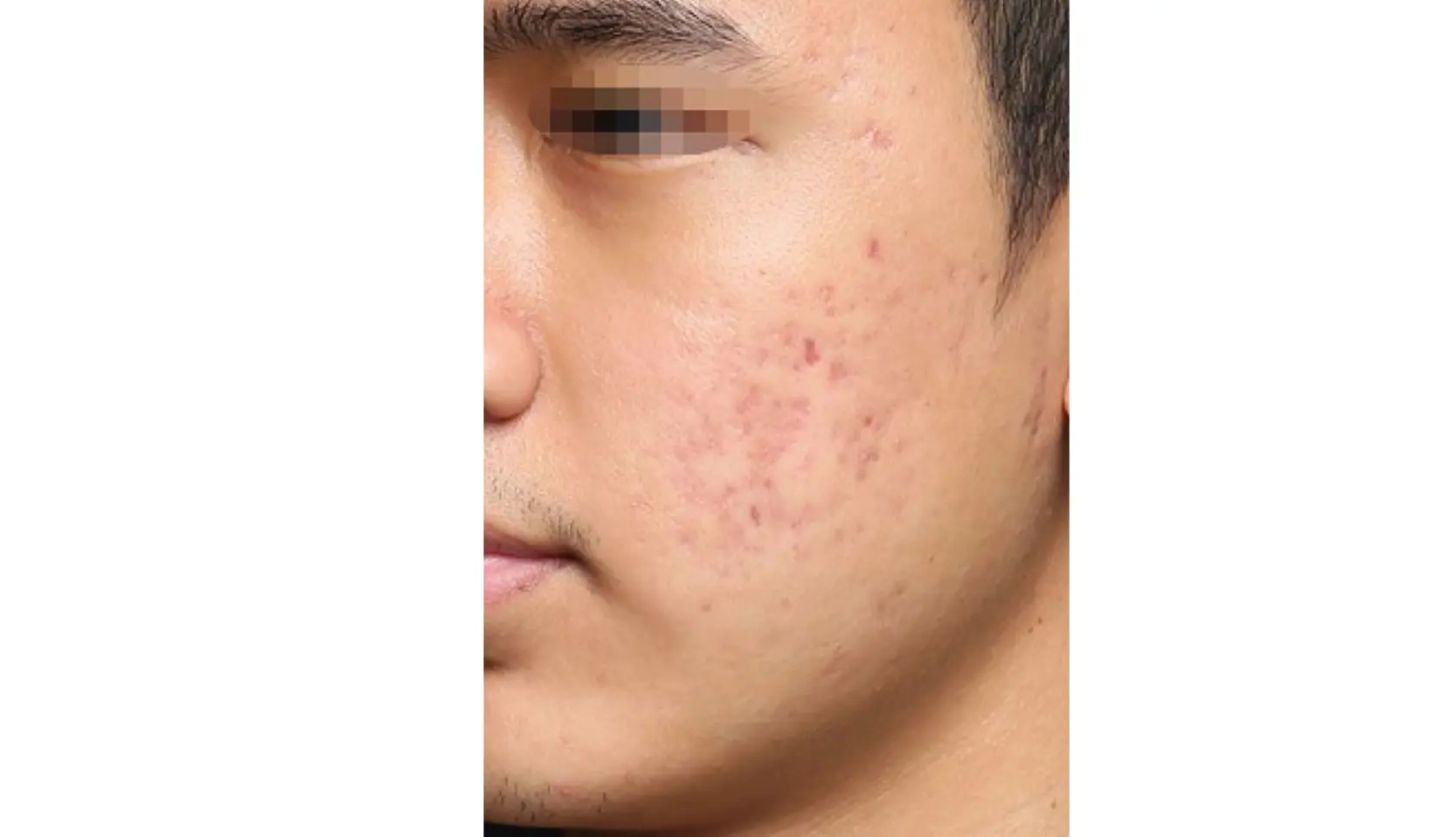 V-SERIES | See results - V-Series